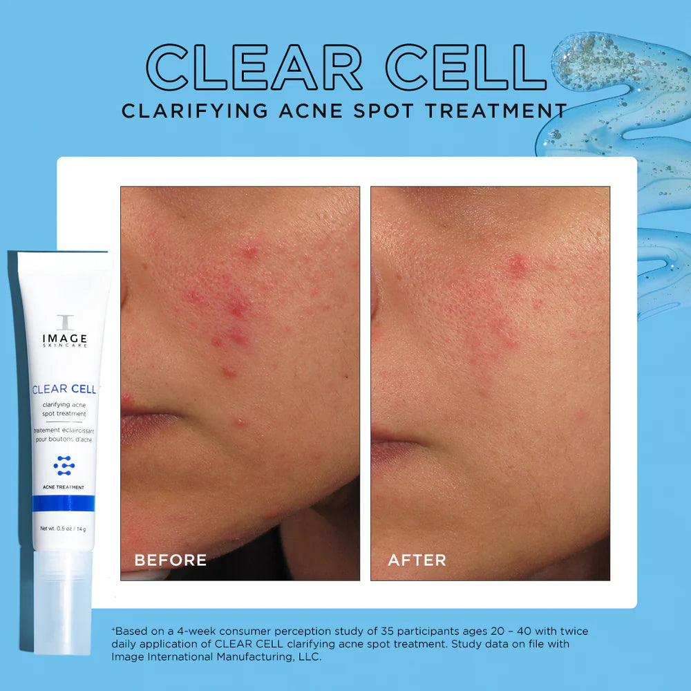 IMAGE SKINCARE CLEAR CELL clarifying acne spot treatment